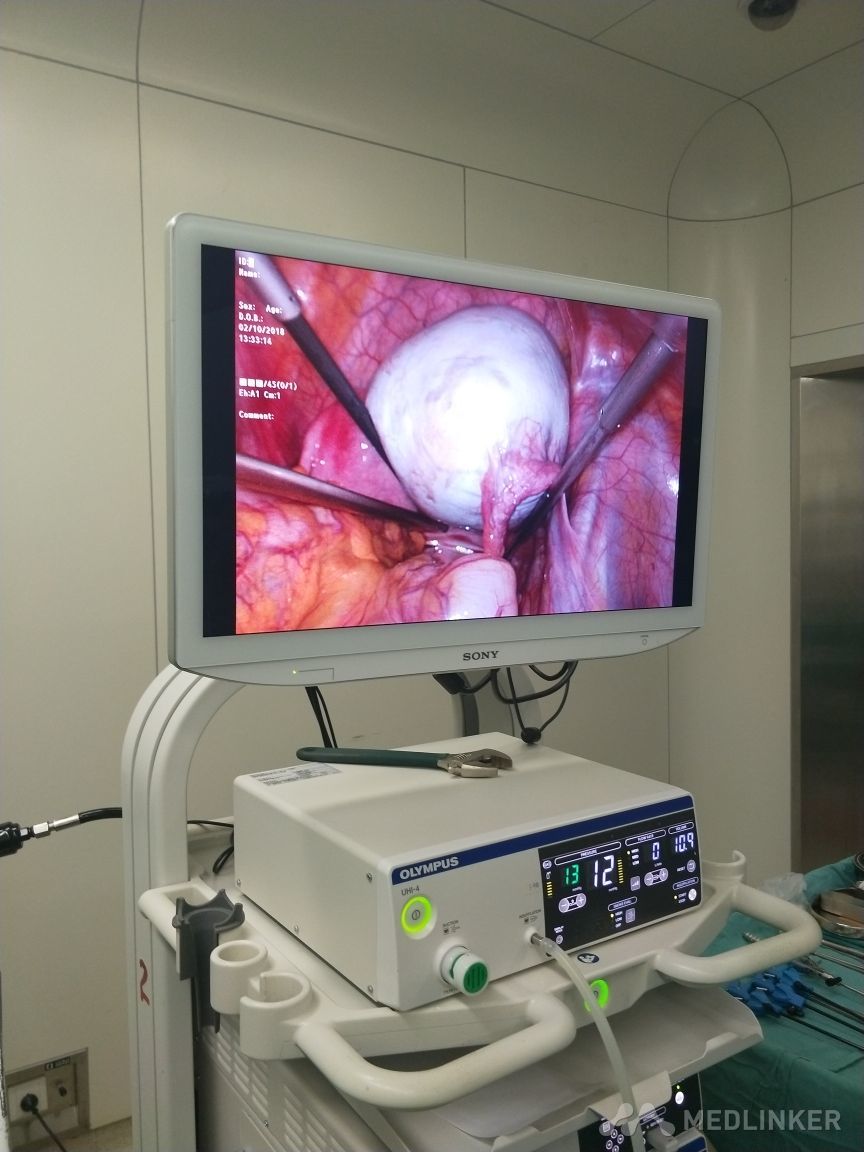 畸胎瘤腹腔镜手术图片